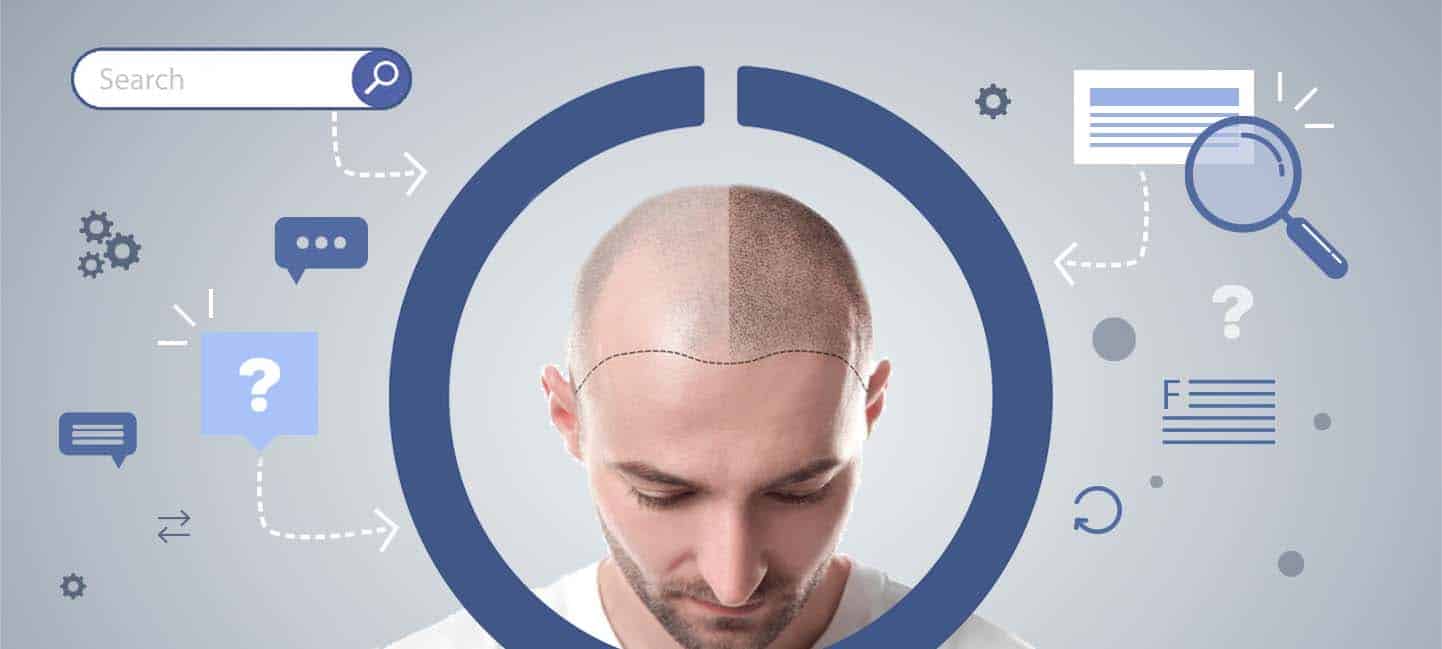 19 Deja Cicatriz el Injerto de Cabello