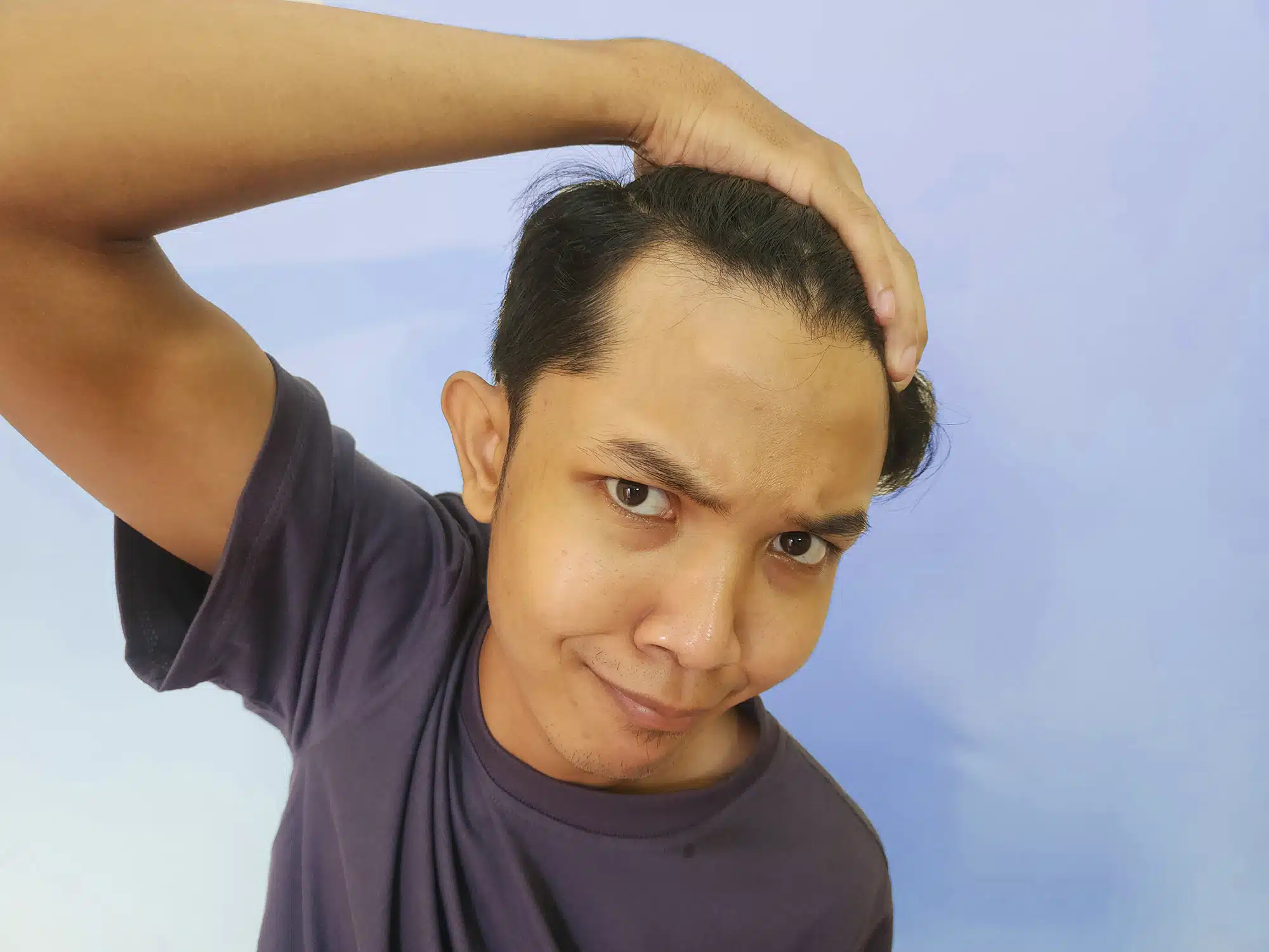 Por que se me cae el cabello si soy joven