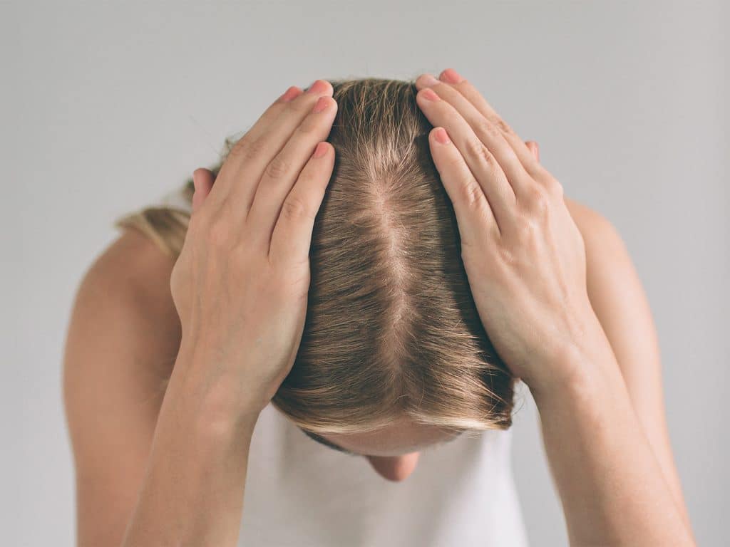 Alopecia en mujeres: 4 tipos y cómo identificarla a tiempo 3 Como identificar la alopecia en mujeres