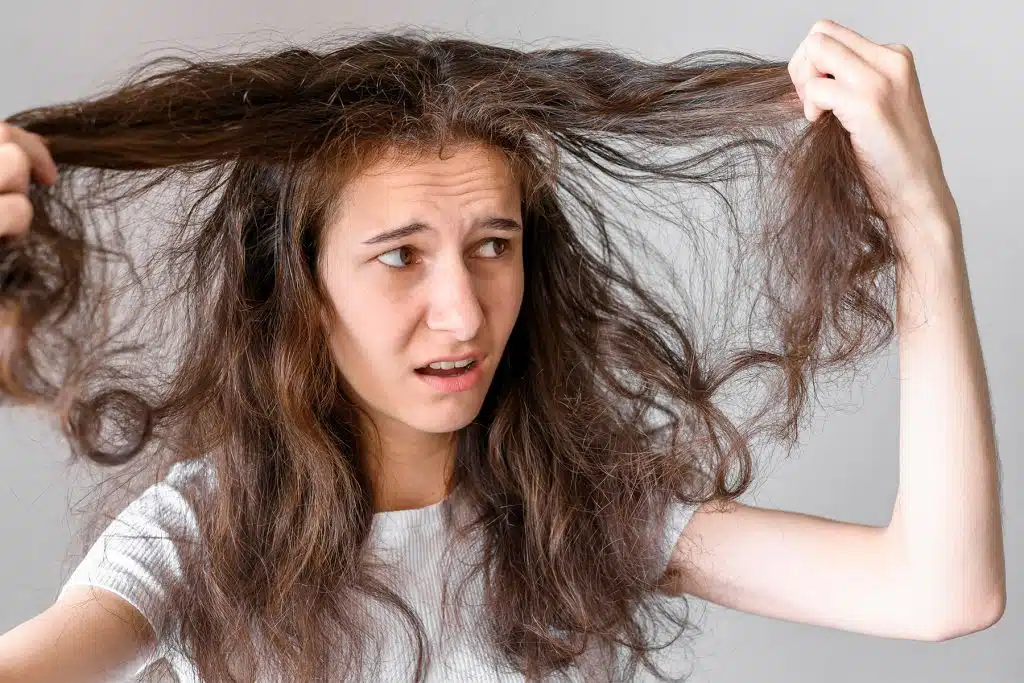 Caída de cabello en mujeres: 6 Causas comunes y cómo tratarla 1 Es normal que se me caiga el cabello