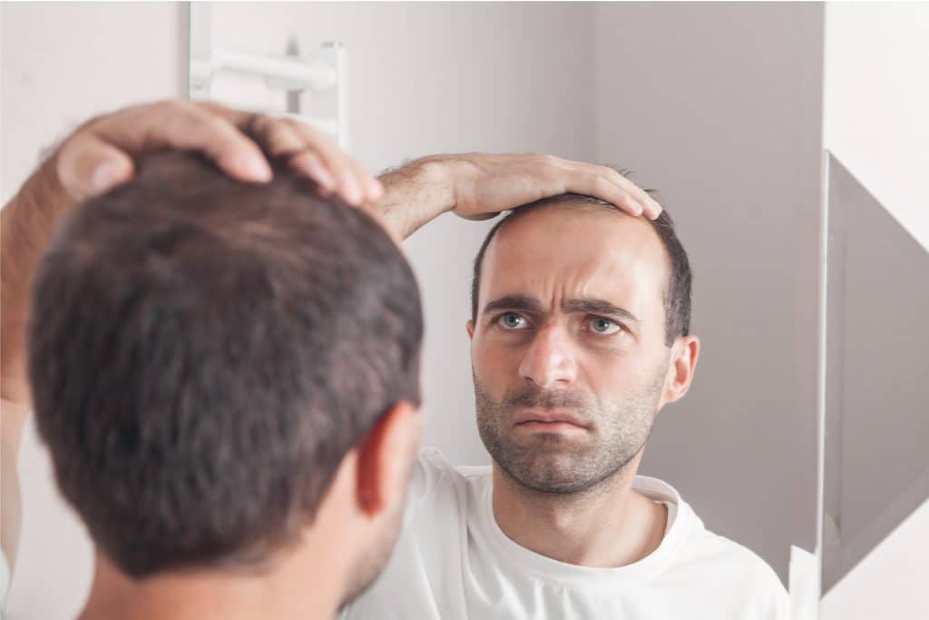 Alopecia por estrés: lo que dice la ciencia y 5 soluciones existen 5 La caida de cabello por estres se detiene sola