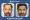 Resultados Injerto Capilar Aaron Balderi