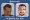 Resultados Injerto Capilar Alberto del Rio