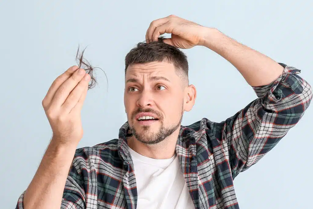 Alopecia por estrés: lo que dice la ciencia y 5 soluciones existen 3 Senales de que estas perdiendo cabello por estres