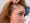 Tipos mas comunes de alopecia en mujeres