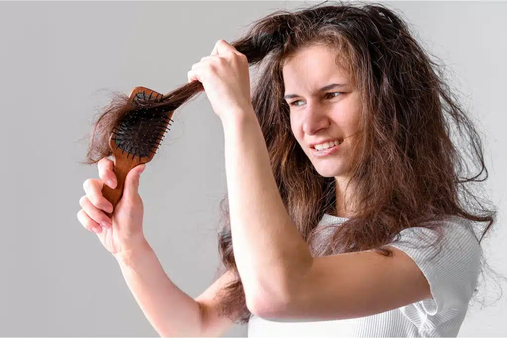 7 enfermedades que causan la caída del cabello en mujeres y cómo tratarlas 3 Mujer observando caída excesiva del cabello al cepillarse, un síntoma frecuente de efluvio telógeno