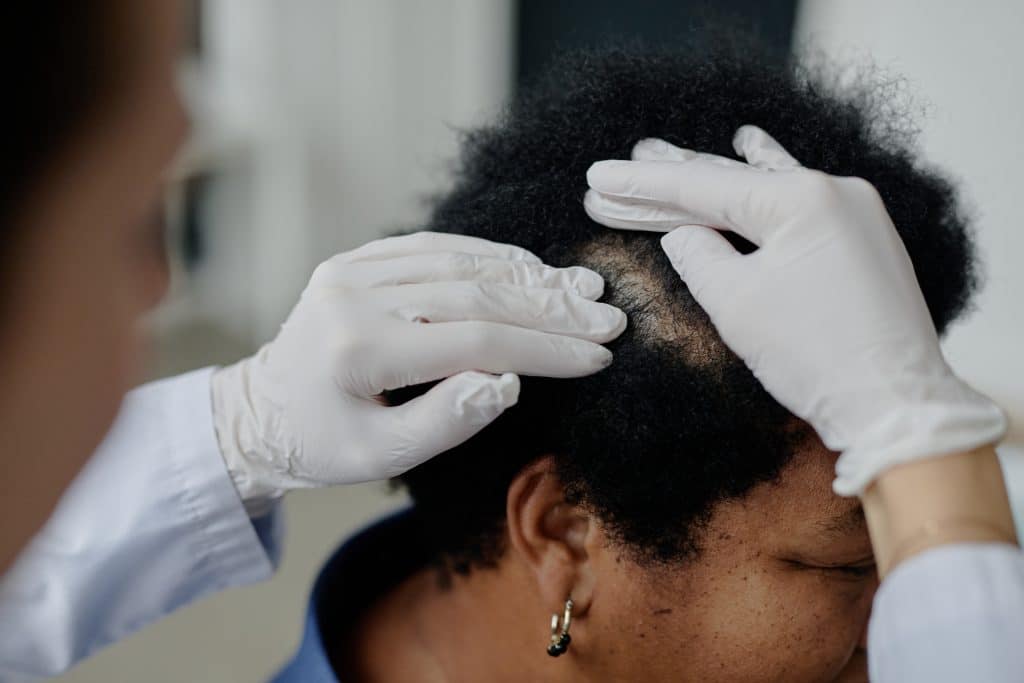 ¿El agua caliente daña el cabello? Lo que debes saber 2 especialista revisando el cuero cabelludo para detectar daño capilar causado por hábitos de lavado