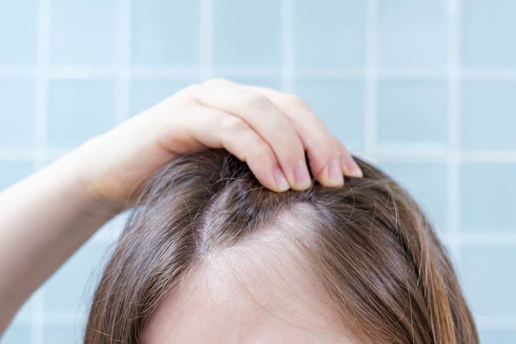 Primer plano de una mujer revisando el estado de su alopecia