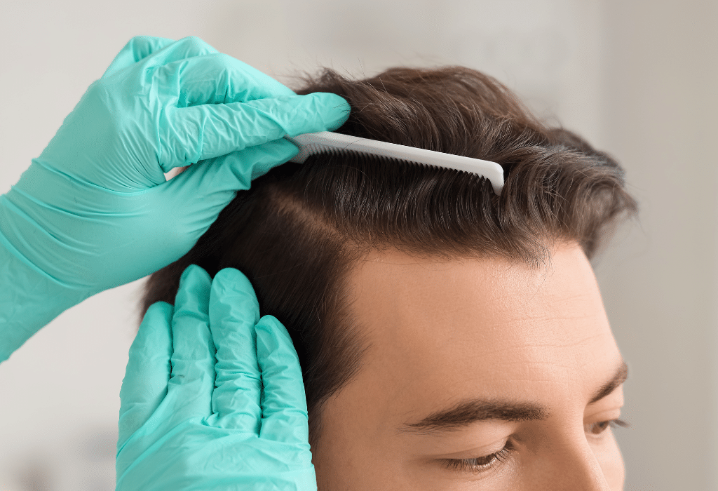 Entradas o coronilla: ¿qué zona conviene tratar primero con injerto capilar? 1 Paciente con pérdida de cabello en las entradas durante una valoración capilar