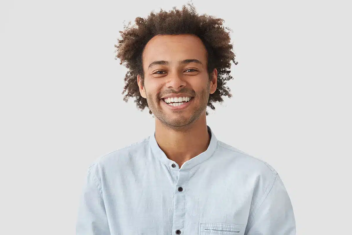 Injerto capilar en cabello rizado o afro: qué cambia en la técnica y la planificación 2 Técnica FUE en cabello rizado