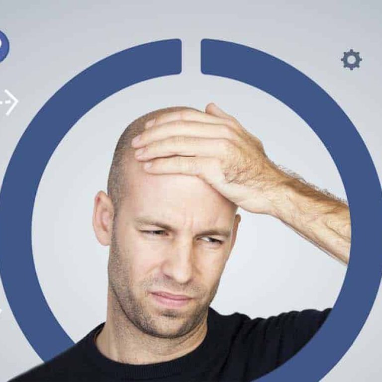 Micropigmentación Capilar