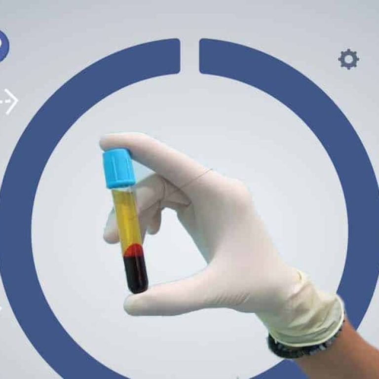 Plasma Rico en Plaquetas