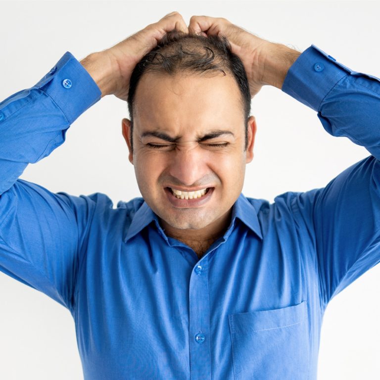 Alopecia por estrés